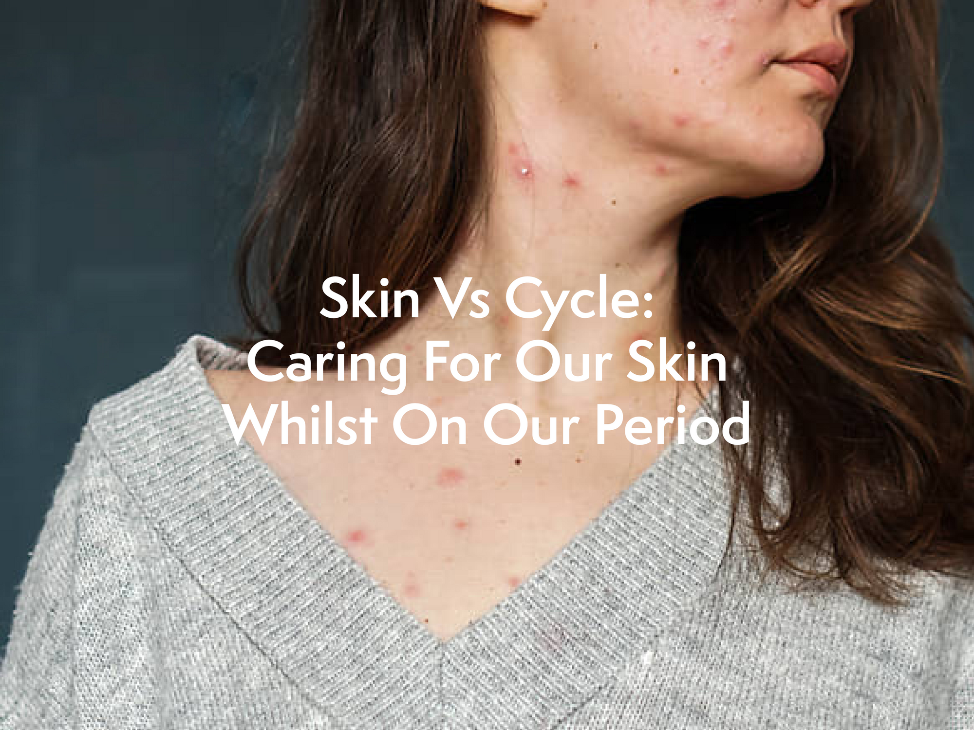 Skin Vs Cycle: How We Should Be Caring For Our Skin Whilst On Our Period